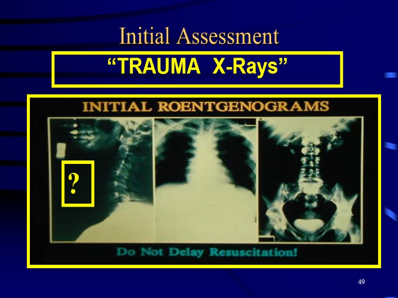 49 Initial Assessment “TRAUMA  X-Rays” ?